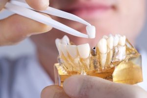 clinica dental en benidorm