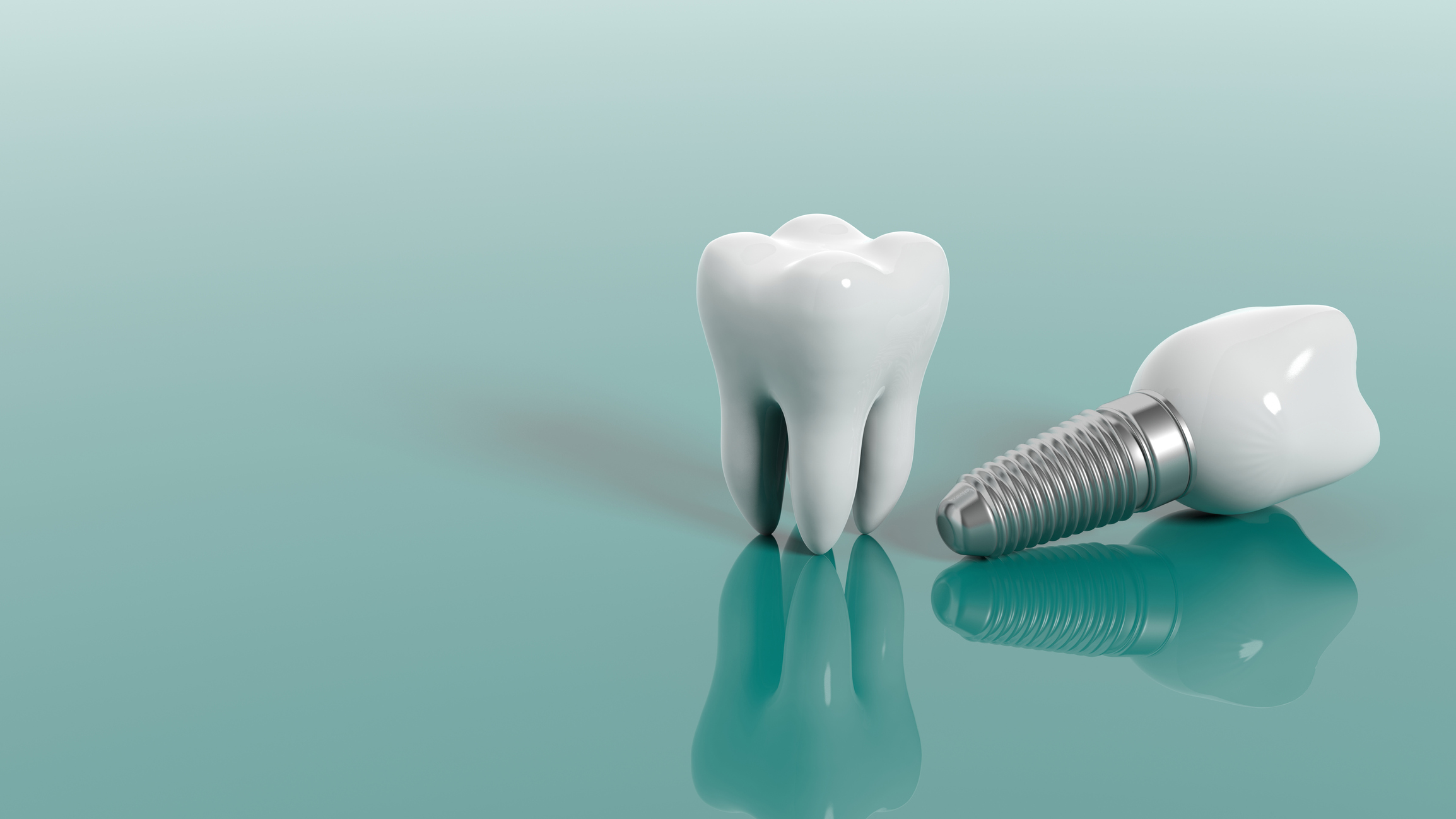 Implantes dentales en Benidorm
