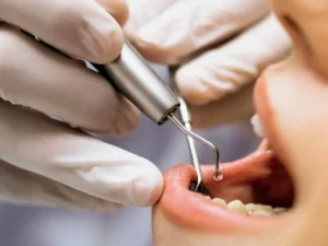 elegir al mejor dentista en Benidorm